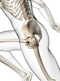 Sports injury